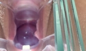 Cervix Closeup Using Speculum - See Inside Her Pussy