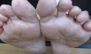 Dry Mature Soles Toes Natural Nails